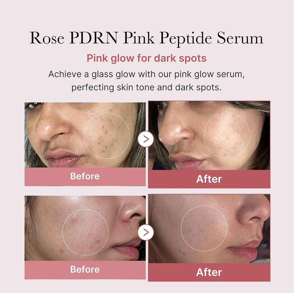 Glow Boost Hydrating Serum